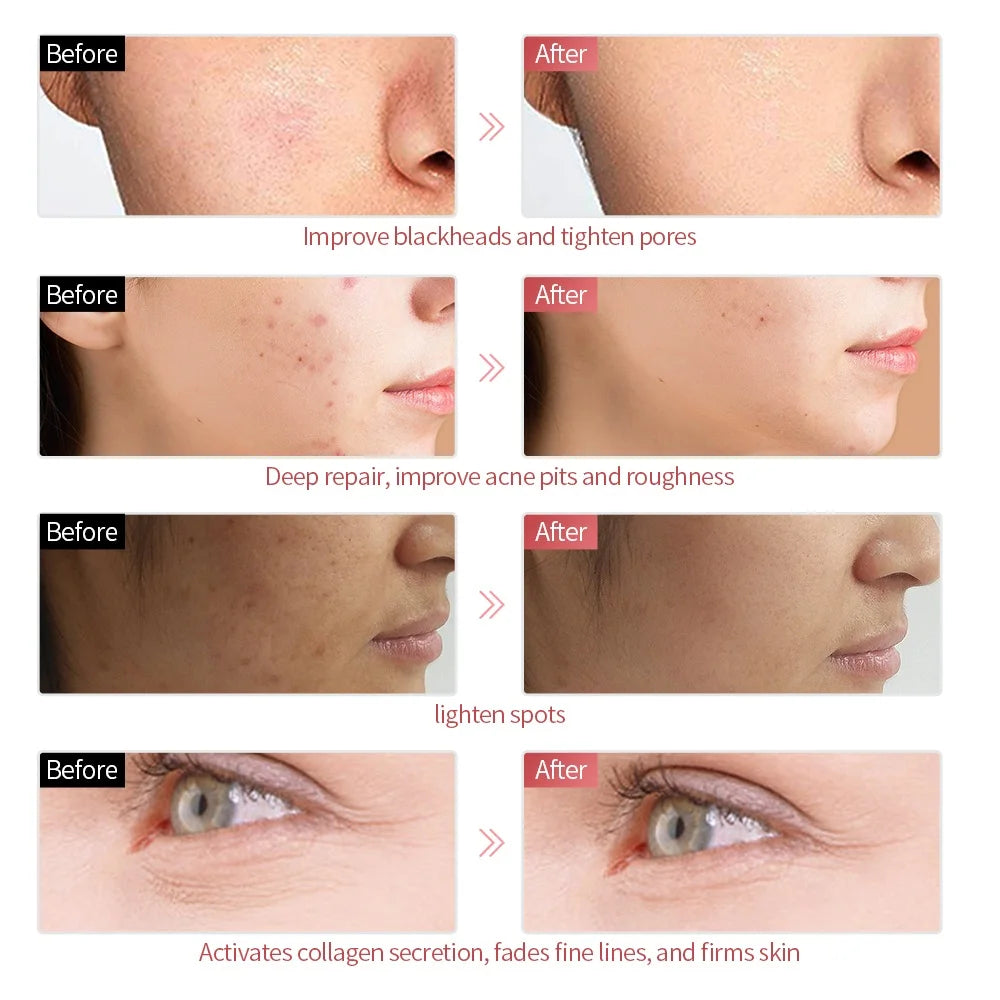 7 Colors LED Face Beauty Machine Red Light Therapy Skin Care Led Mask Home Use Devices Skin Tighten Rejuvenation Facial Mask