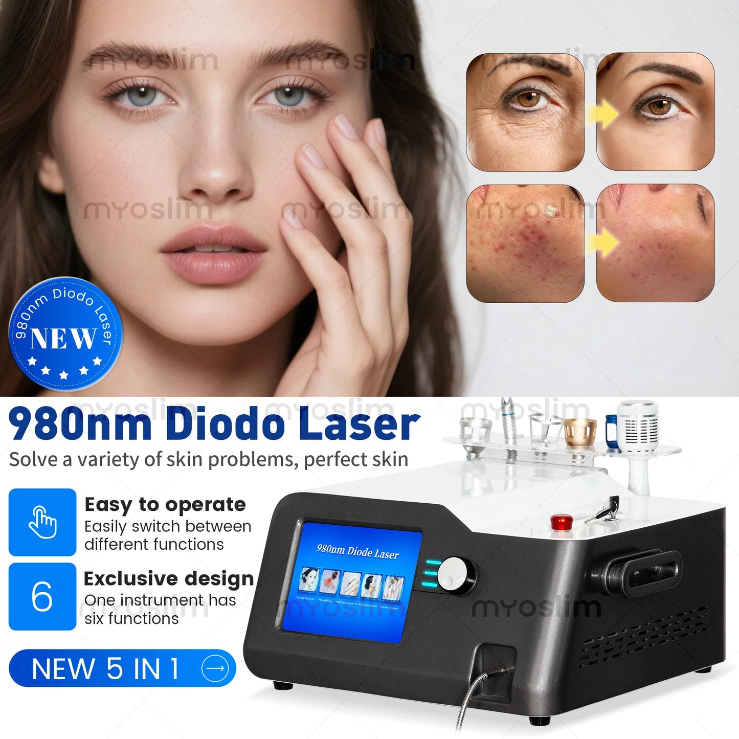 Professional Diode Laser Equipment for Skin Rejuvenation Painless Vascular Removal Cosmetic Machine for Aesthetic Treatments